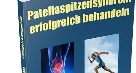 Patellaspitzensyndrom